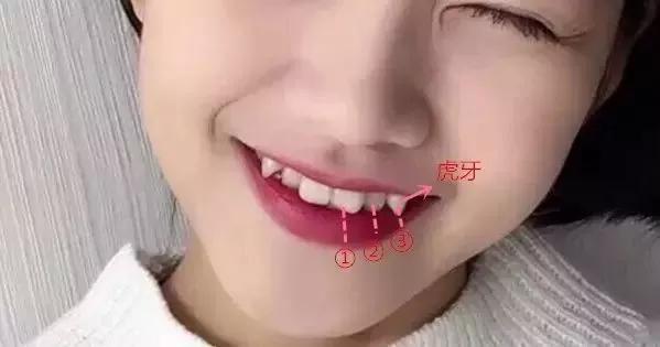 虎牙