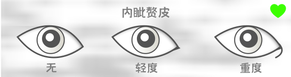 开眼角会让眼睛变大吗？开眼角内外都要开吗？