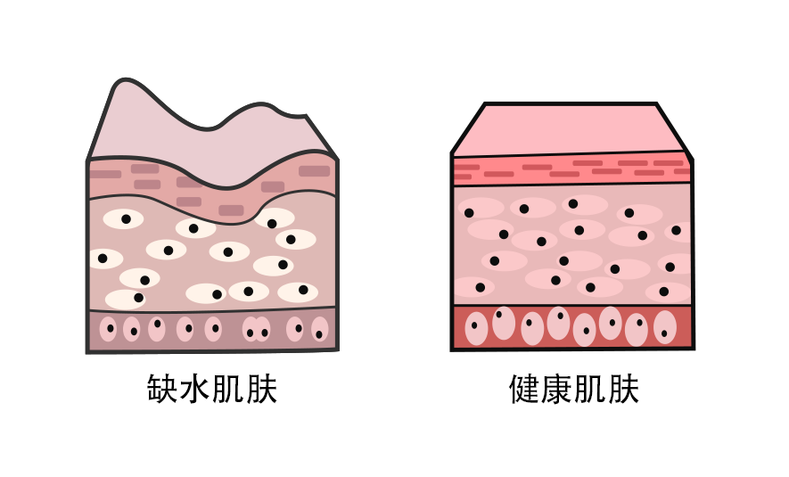 皮肤很干燥做什么医美项目？