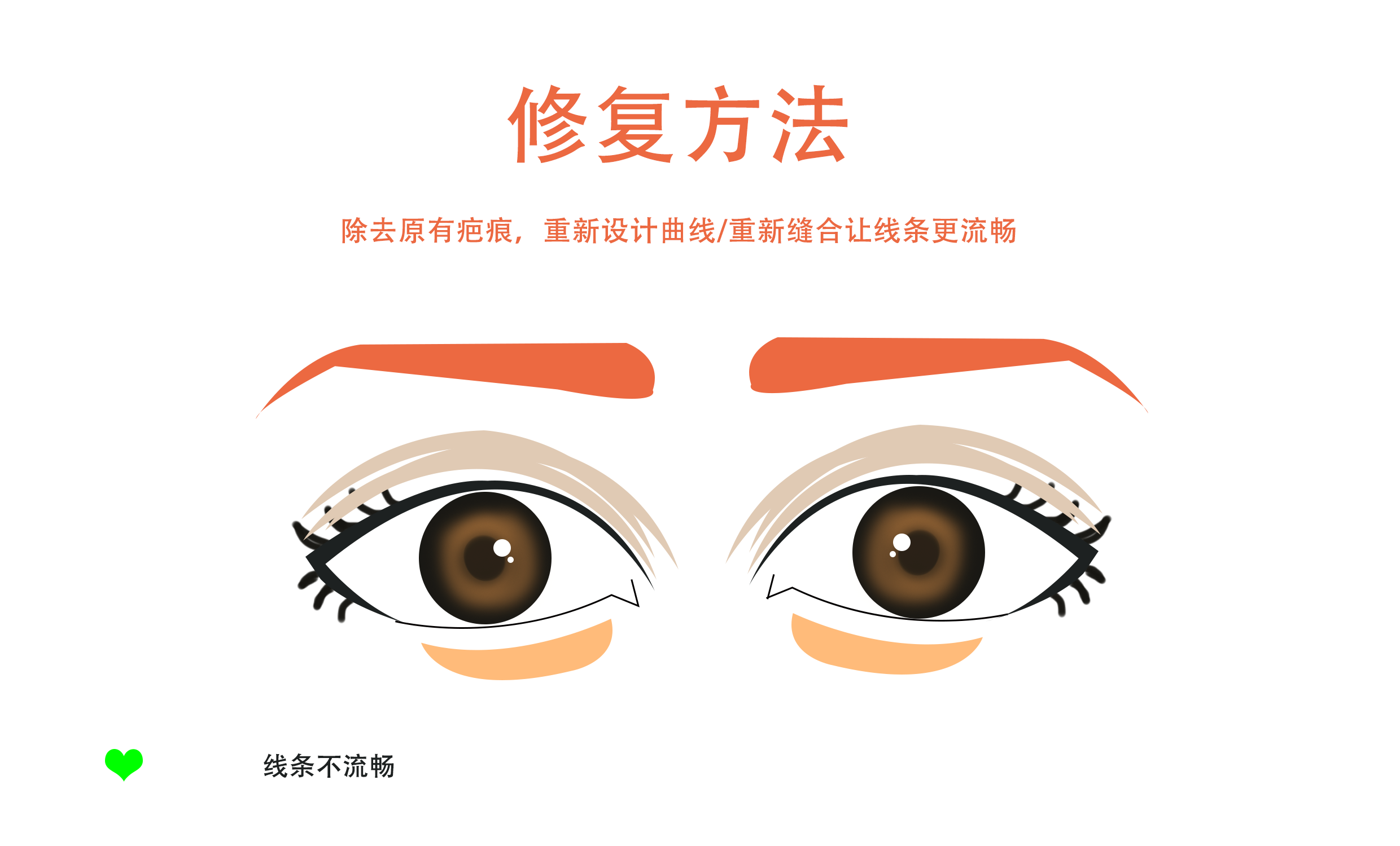 上海华美双眼皮二次恢复要多久?双眼皮二次修复难吗?