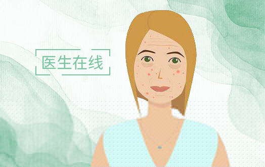 开眼角手术风险大么？开眼角需要多少钱？