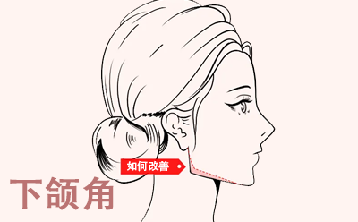 什么样的脸型需要做下颌角手术？