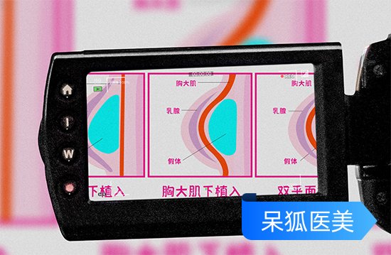 自体脂肪隆胸后多久可以揉胸？