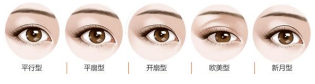 双眼皮手术一般需要多长时间？
